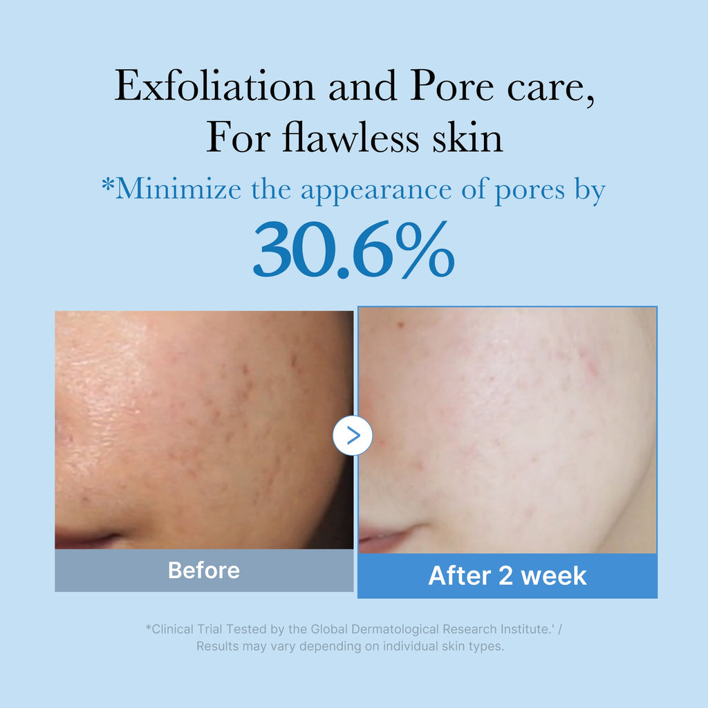 Zero Pore Toner V3