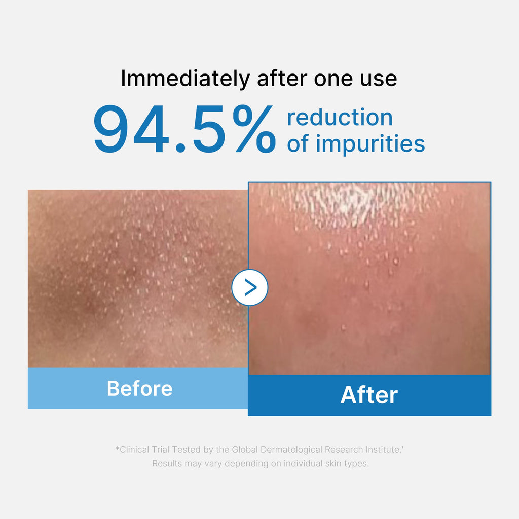 Zero Pore Blackhead Deep Cleansing Oil X9