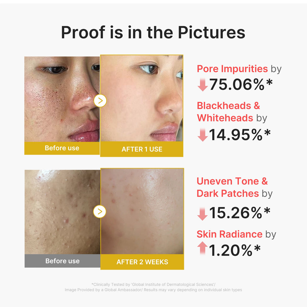 Kojic Acid Turmeric Peel Shot T6