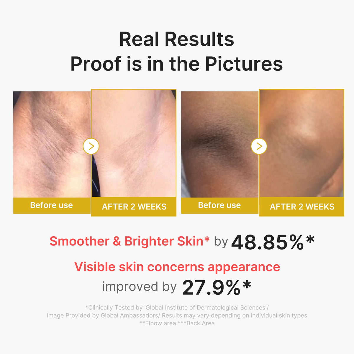 Kojic Acid Turmeric Body Peel Shot P7