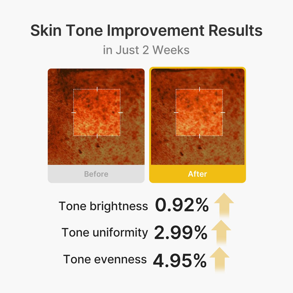 Kojic Acid Turmeric Vita Capsule Cream I9