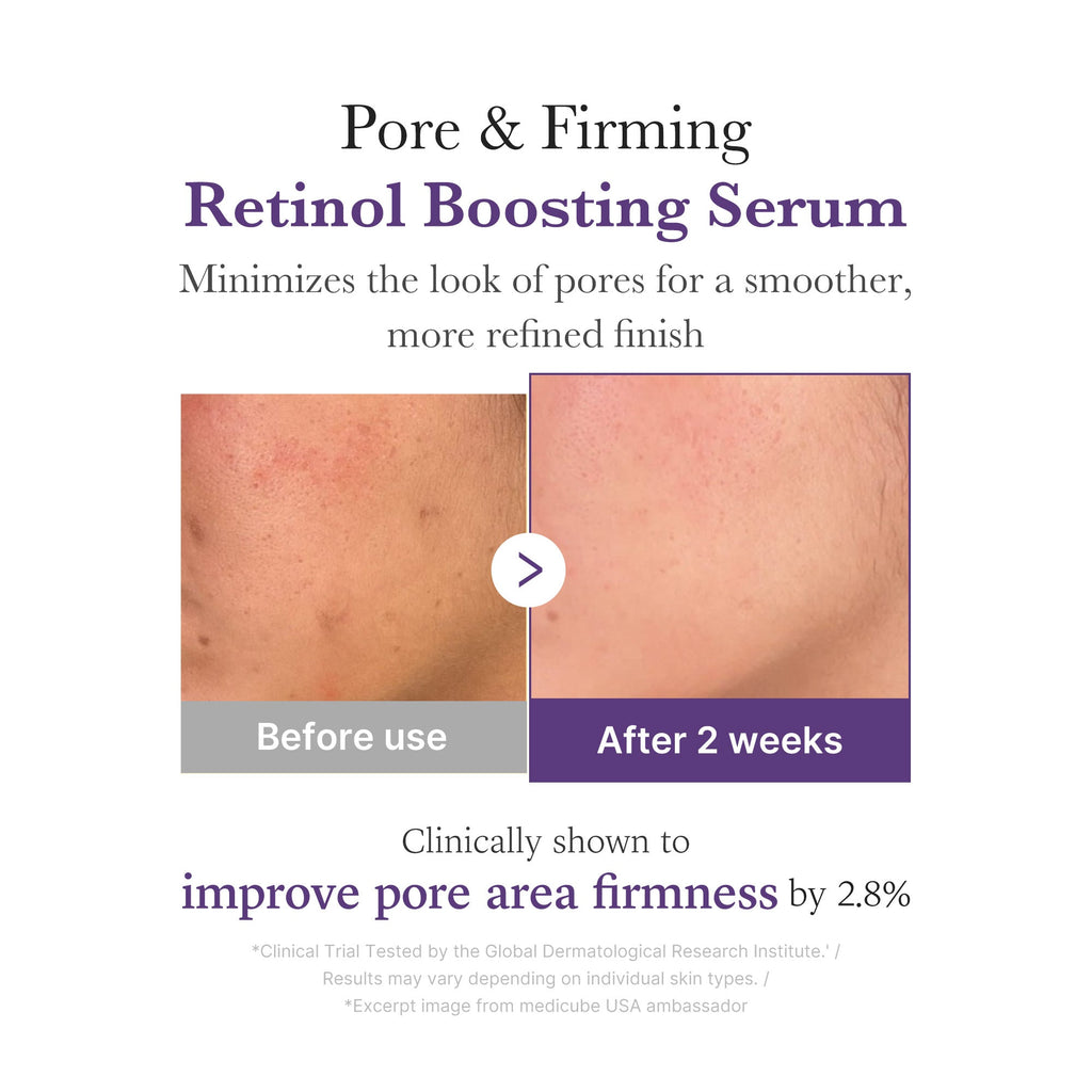 Retinol NMN Boosting Serum F2