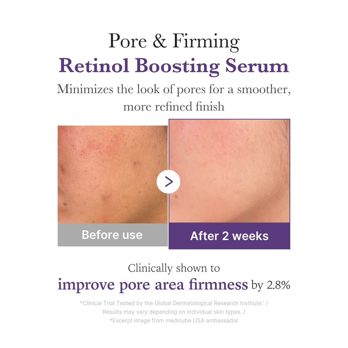 Retinol NMN Boosting Serum F2