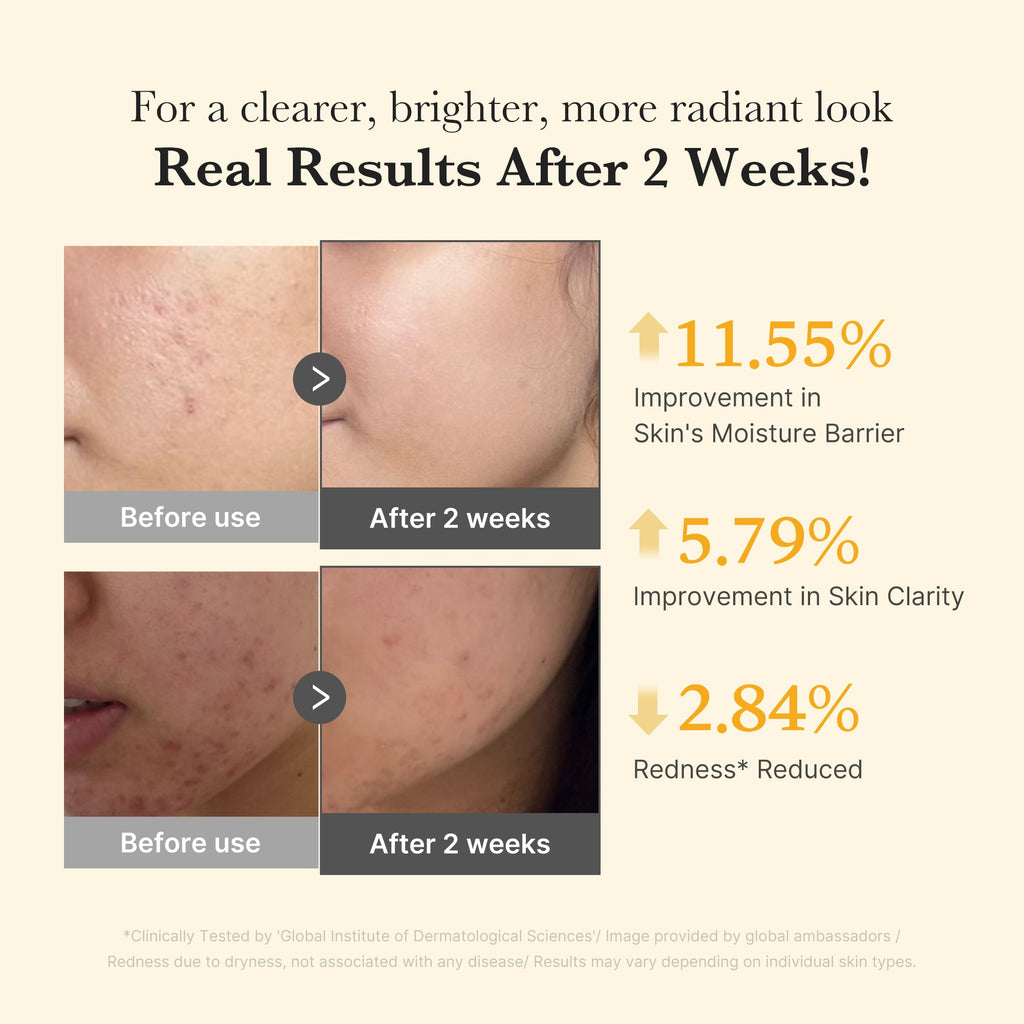 Kojic Acid Turmeric Capsule Serum O2