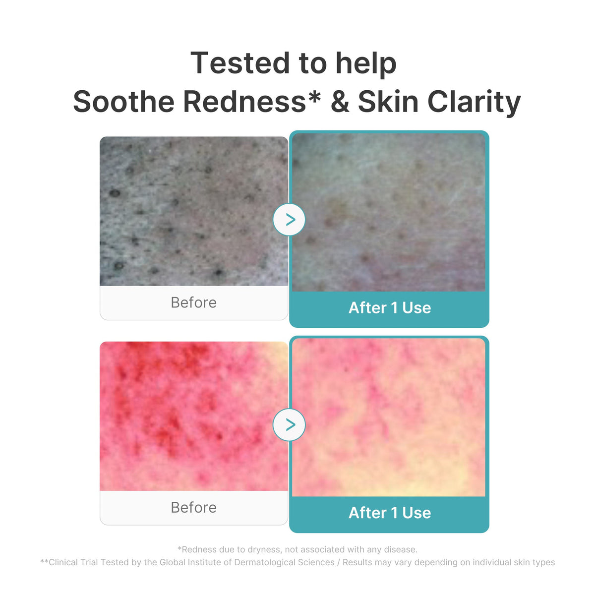 Azelaic Acid Capsule Foam Cleanser U0