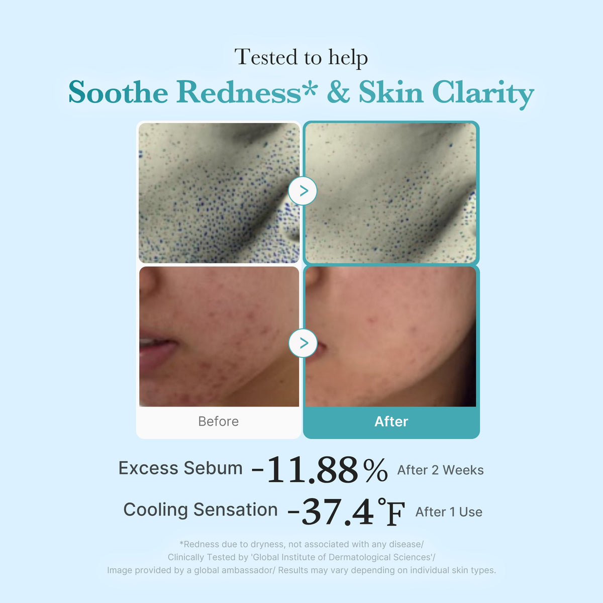 Azelaic Acid Niacinamide Clarifying Toner A8