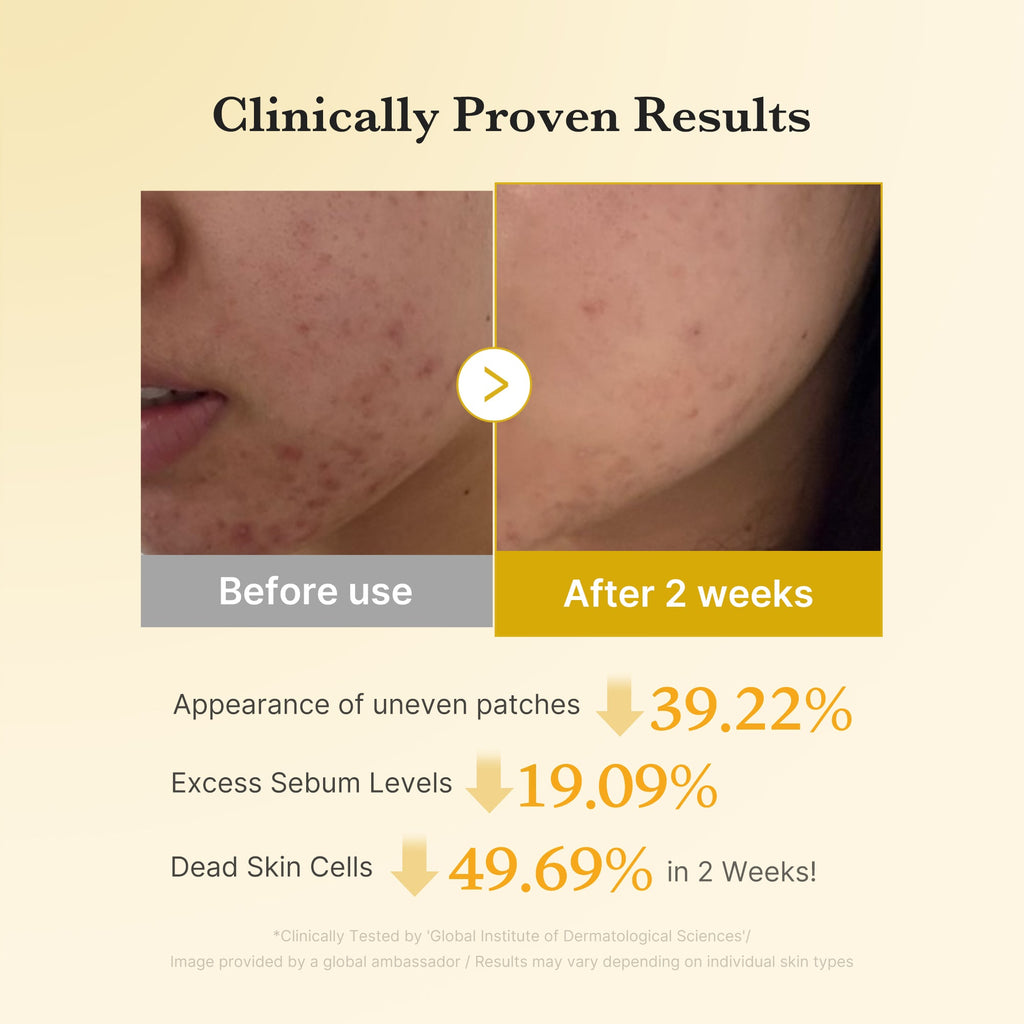 Kojic Acid Tumeric Toner Pad T2