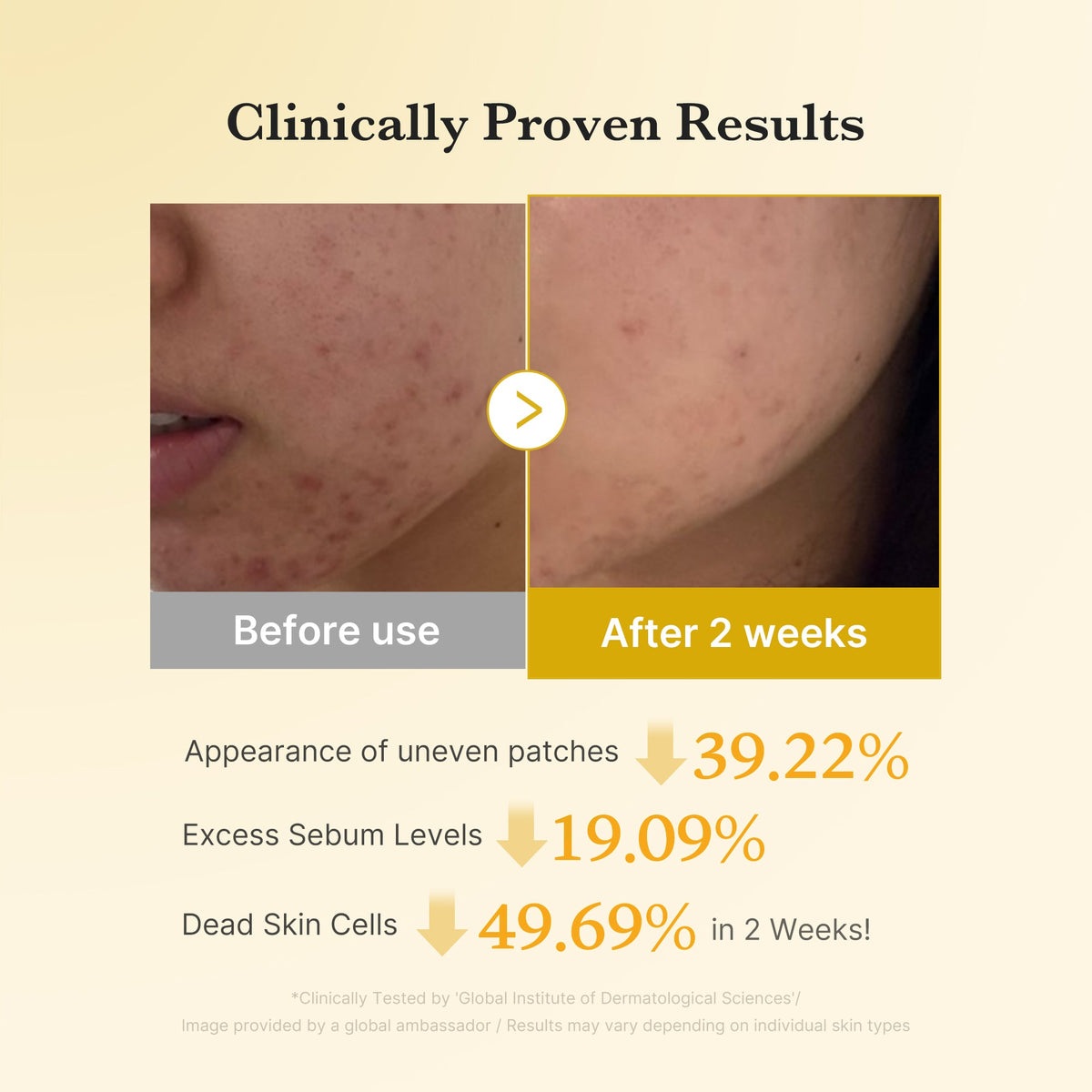 Kojic Acid Tumeric Toner Pad T2