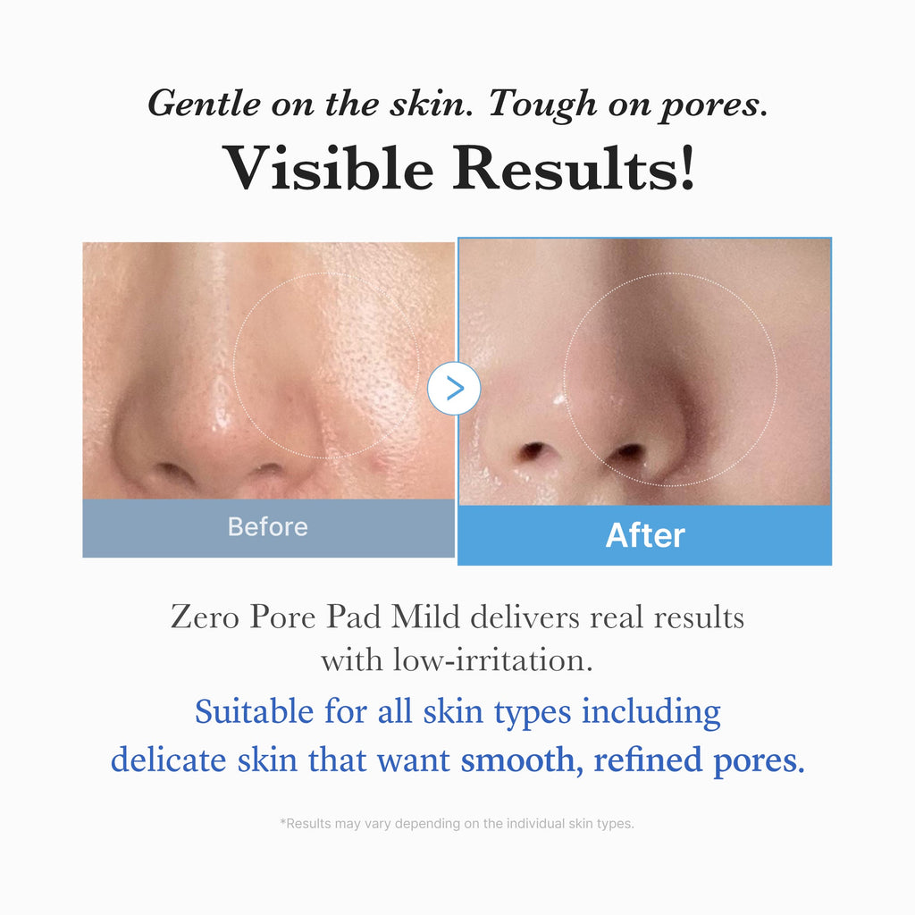 Zero Pore Madecassoside Pads (Mild) O7