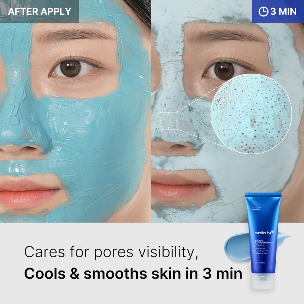 Zero Pore Blackhead Mud Mask A0