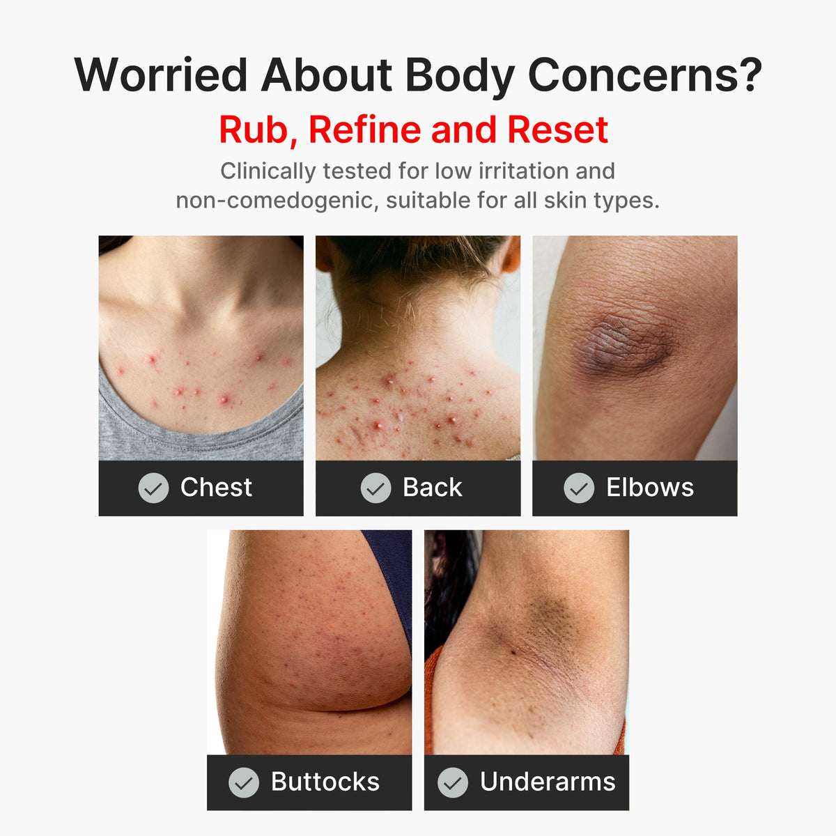 Kojic Acid Turmeric Body Peel Shot Y4