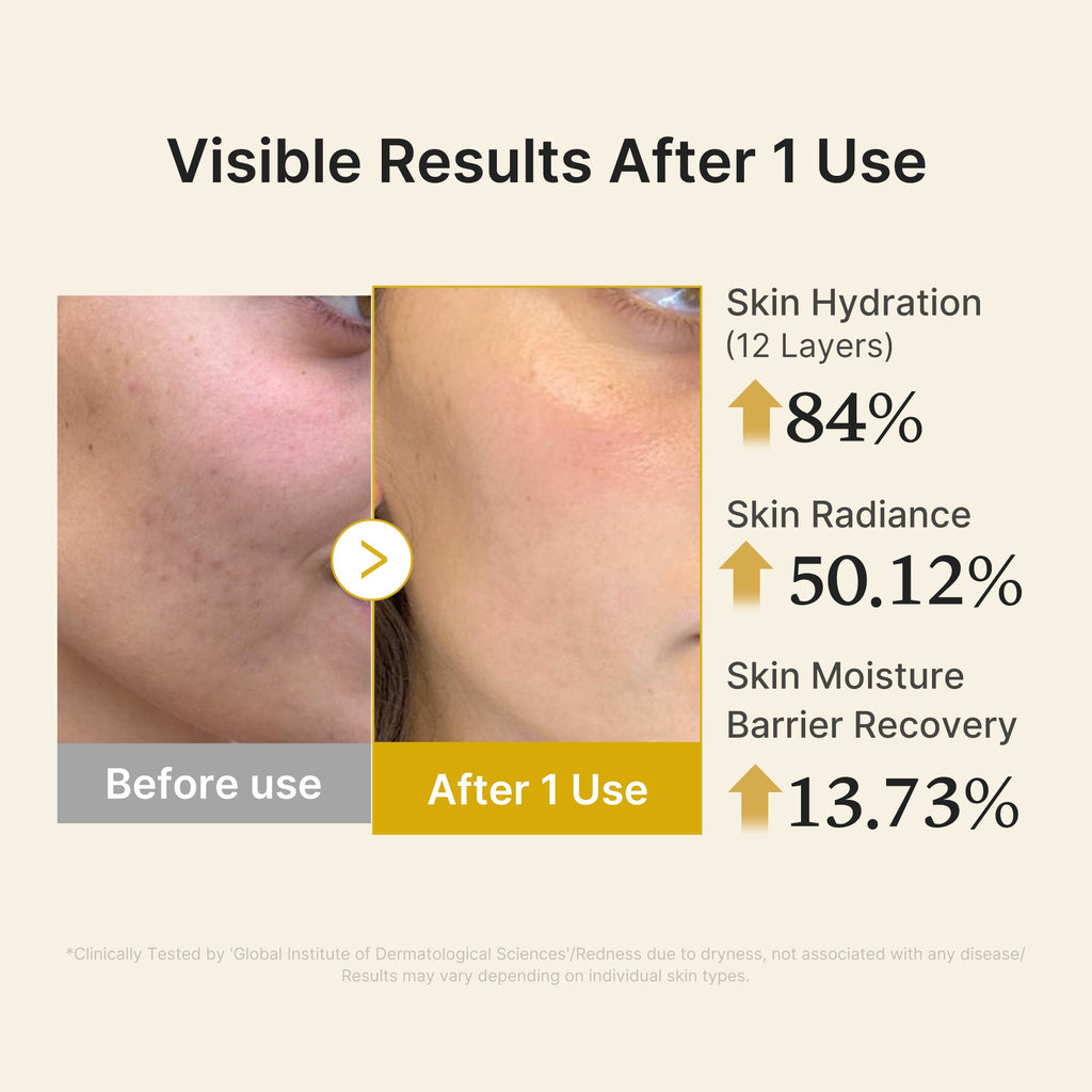 Kojic Acid Turmeric Vitamin Gold Jelly Mist Serum P7