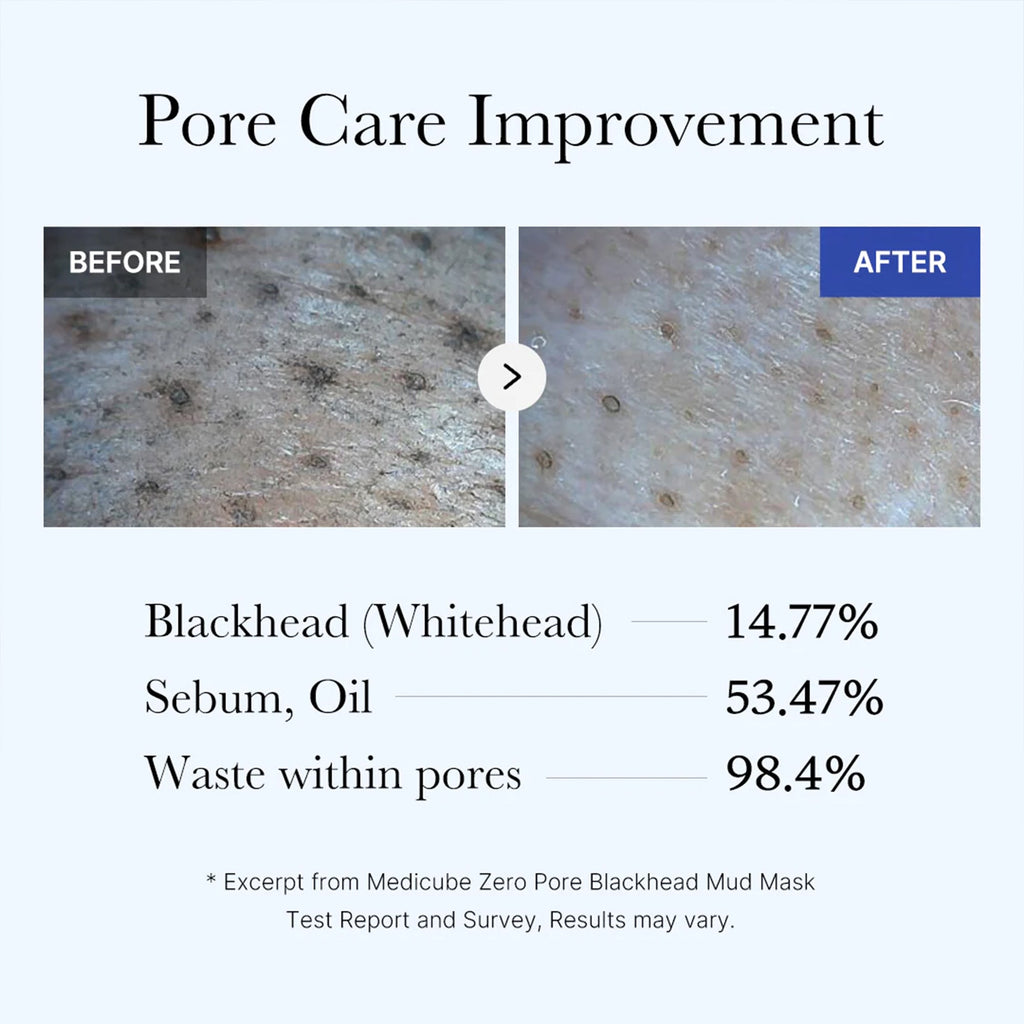 Zero Pore Blackhead Mud Mask A0