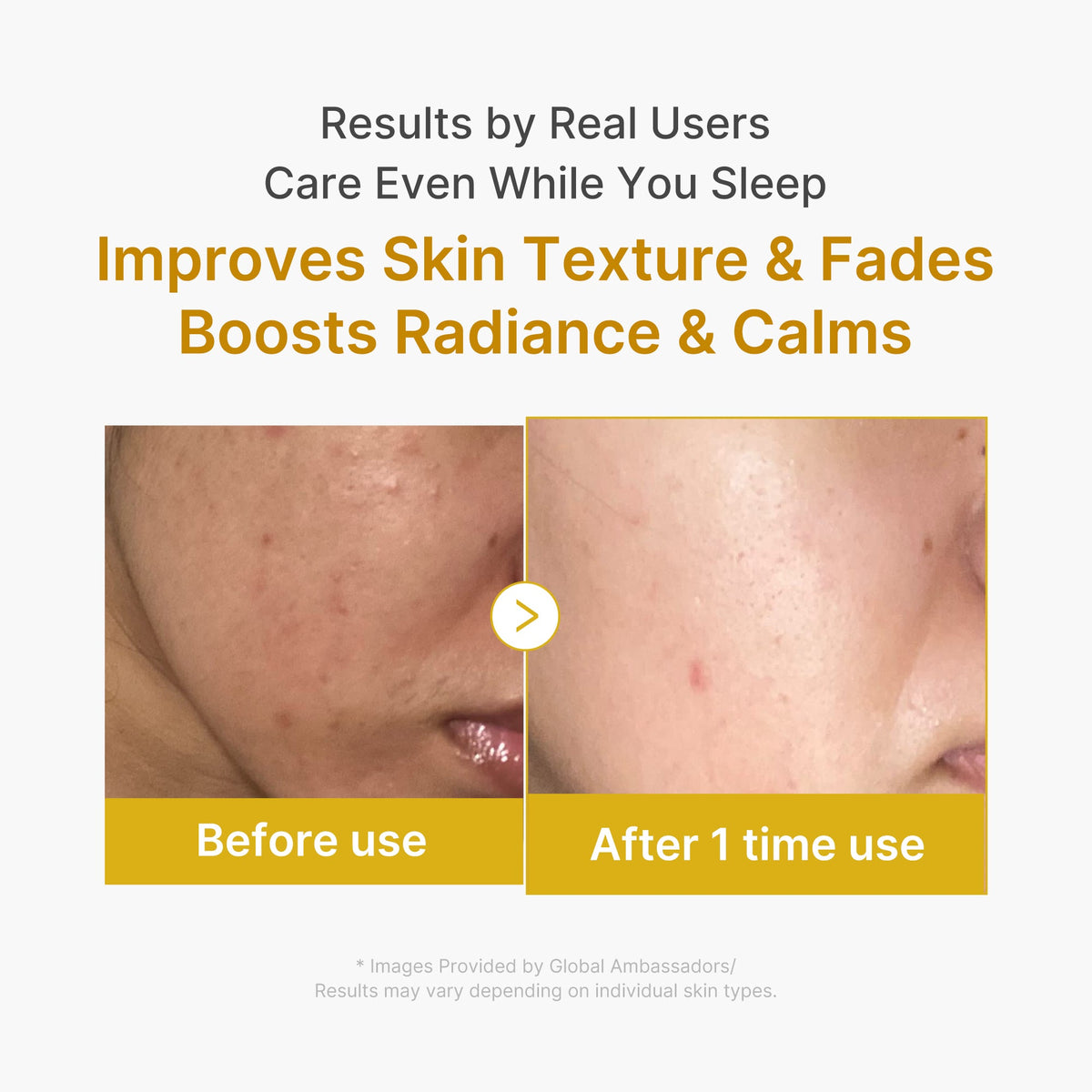 Kojic Acid Turmeric Overnight Wrapping Mask P5