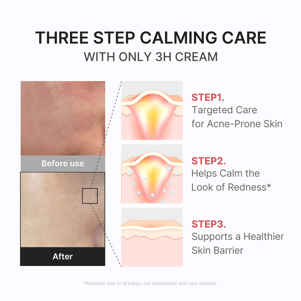 3H Daily Relief Cream W6