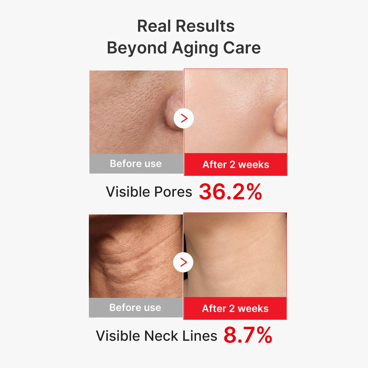 EGF NAD+ Firming Serum D4