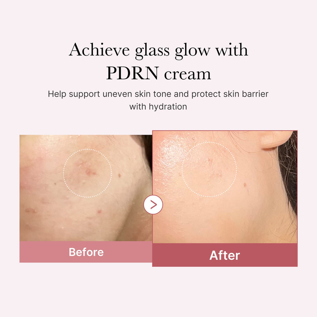 PDRN Pink Peptide Cream O7