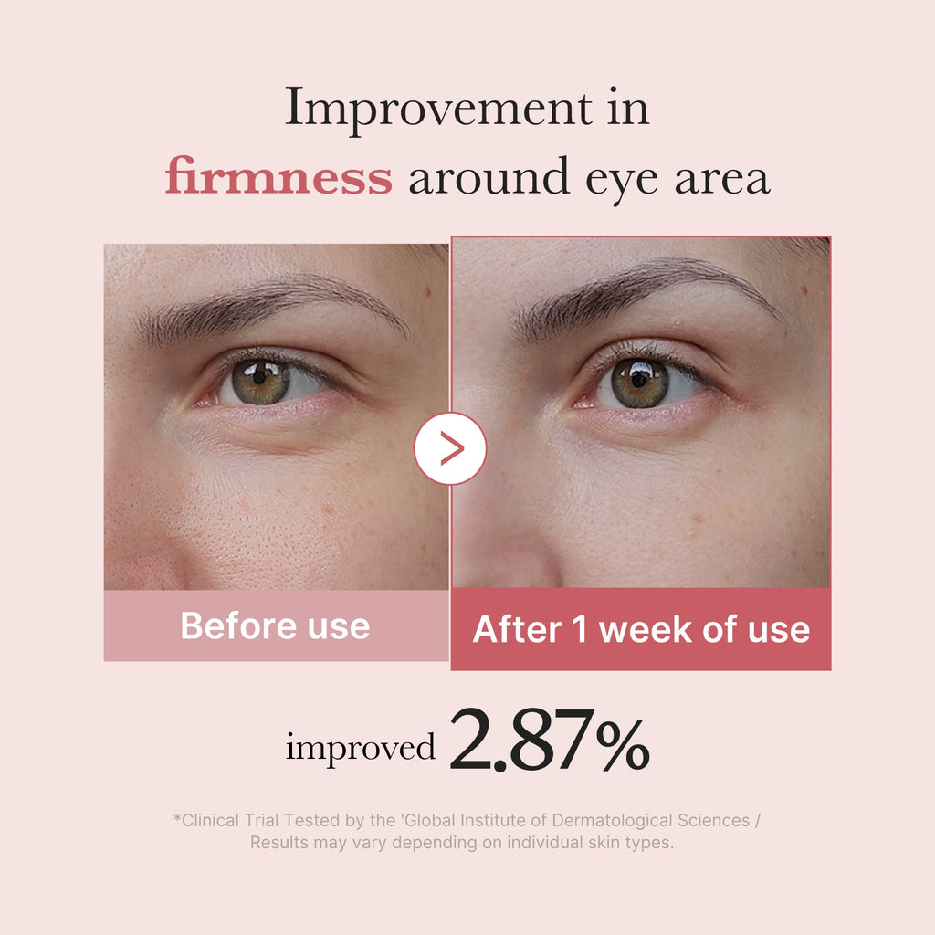 PDRN Pink Peptide Eye Cream O1