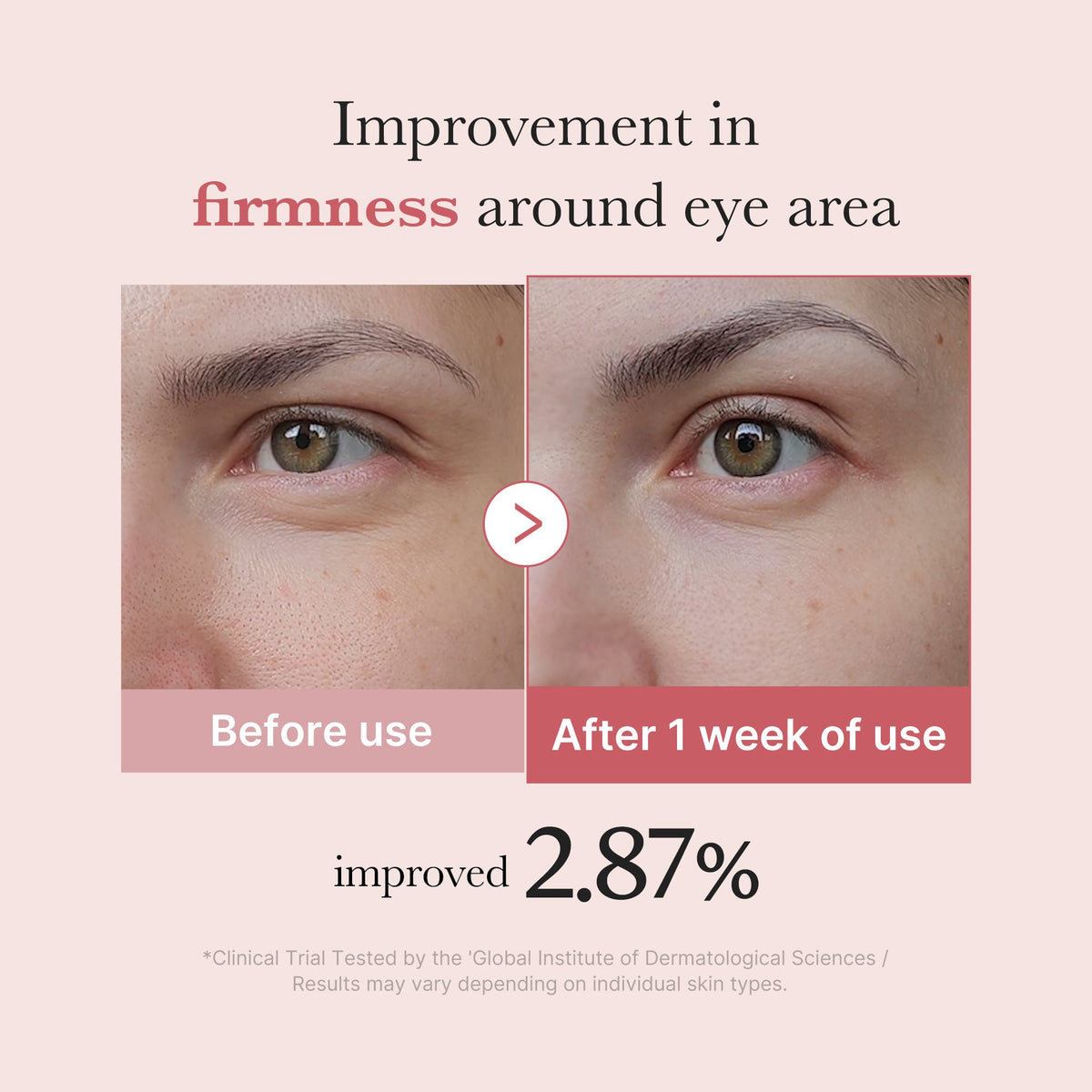 PDRN Pink Peptide Eye Cream O1