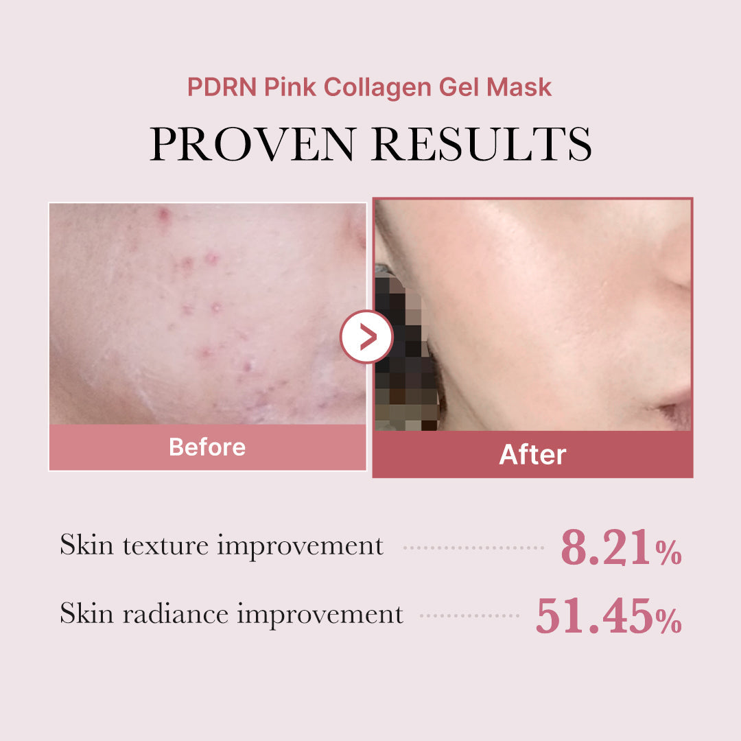 PDRN Pink Glow Full Set O9