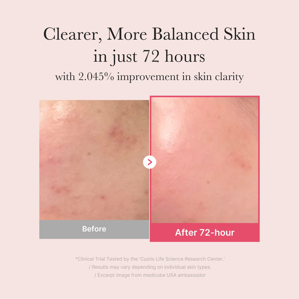 TXA Niacinamide Serum I6