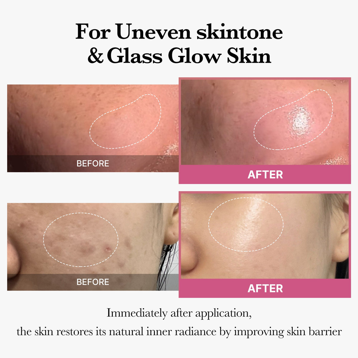 [Tati's Exclusive] All About Glow Set V5